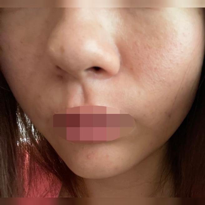 일본어 직원분 덕분에 리쥬란,쥬베룩 편하게 받아봤어요~