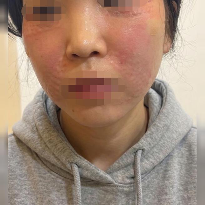 리쥬베룩 받았는데 화장 안 뜨고 건조함도 잡힌 것 같아요 ㅎㅎ