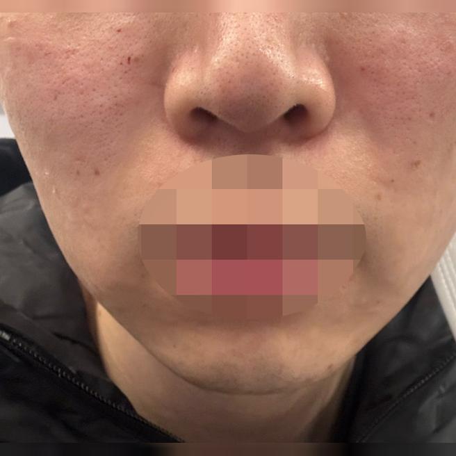 예약시간 맞춰 안내해주시고 필요한 시술만 상담해줘서 좋았어요!