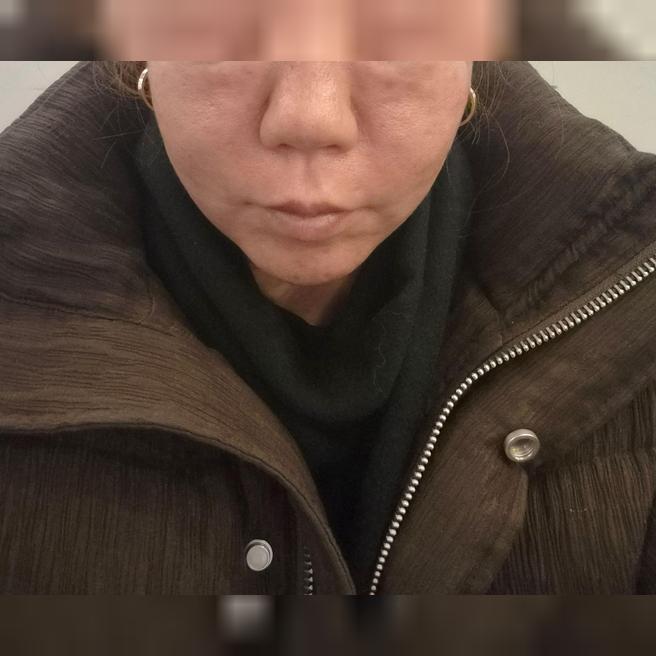 1년에 한 번 필수 루틴! 리쥬란은 고민 없이 여기서만 받아요