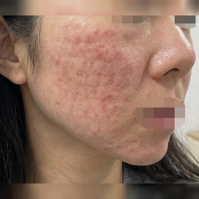 리쥬란 받고 친구가 피부 좋아졌다고 놀라서 장소 공유해줬어요~