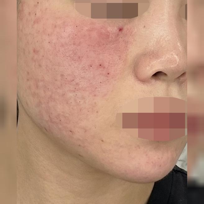 3년째 다니는데 가격 합리적이고 효과 확실해요 ㅎㅎ