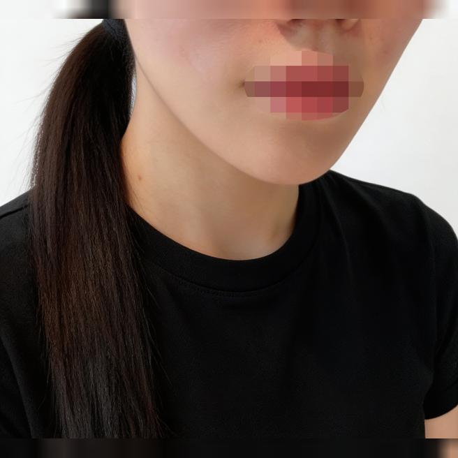 한국 여행 와서 실리프팅 받았는데 일본어 가능하고 친절해서 좋았어요 ㅎㅎ