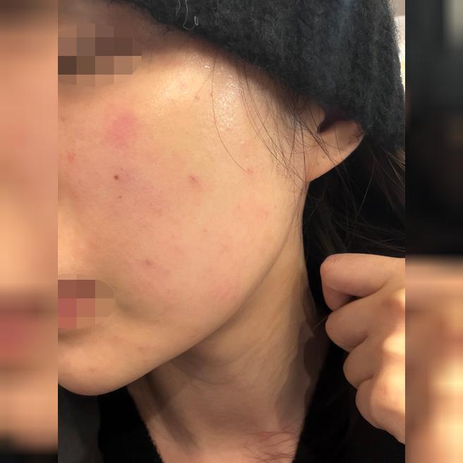 건조해서 쥬베룩 받았는데 친절한 곳 에서 받아서 넘 좋았어요~ 얼굴에 광 나는 게 좋네요 ㅎㅎ