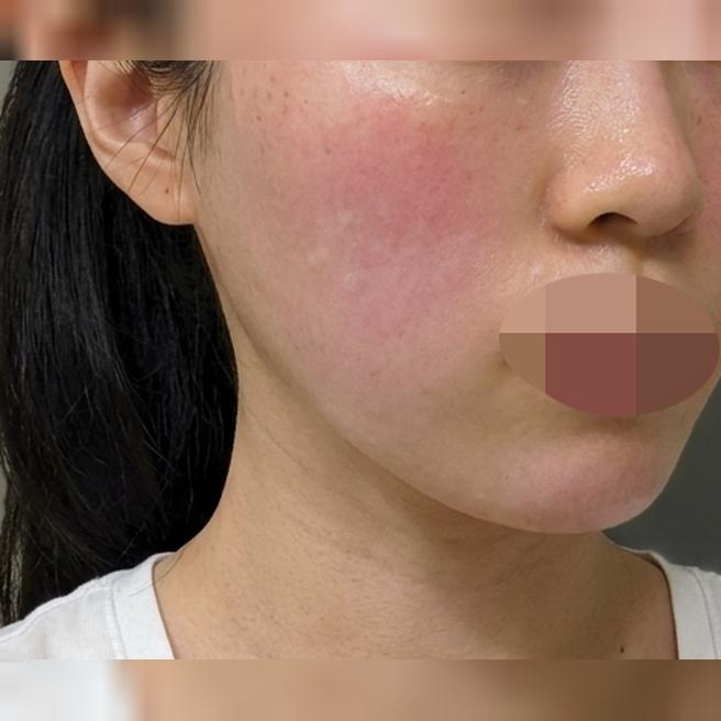 지쳐 보이는 피부 컨디션, 리쥬베룩으로 잡아봤어요ㅎㅎ