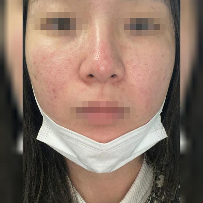건조해서 리쥬란 받았는데 직원분들 친절하고 대기도 짧아서 좋았어요 ㅎㅎ