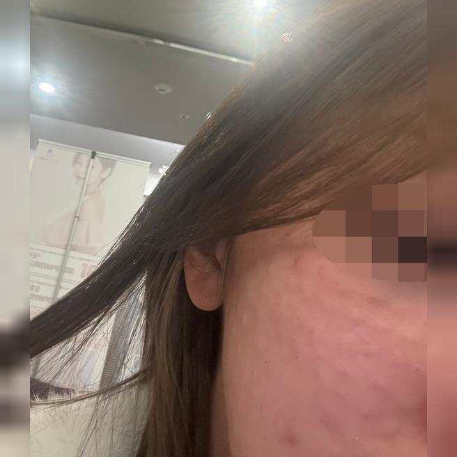 전에는 엠보 없었는데 여긴 짱짱해서 좋은 것 같아요 ㅎㅎ