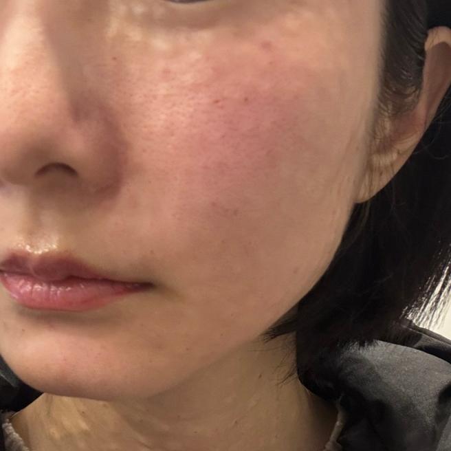 3일차인데 벌써 피부결이 달라지는 것 같은 느낌이에요!