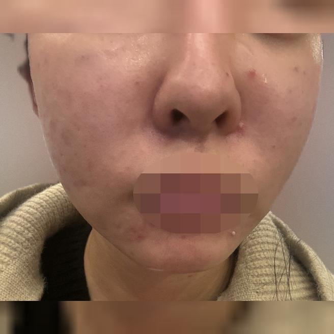 속건조 때문에 1년 넘게 다니는데 가격도 만족이에요~~ㅎㅎ
