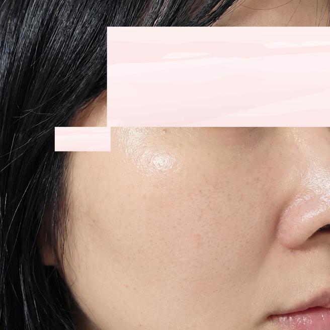 생기 없어 보이는 피부가 고민이라 리쥬베룩 받은 2주차 후기