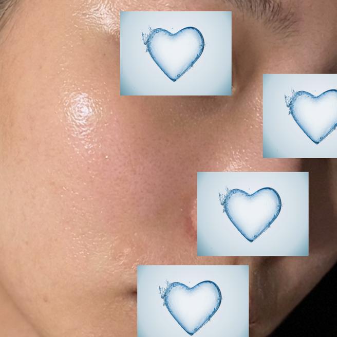 디클래시 붓기 다 빠진 5일차, 이제부터가 진짜인 것 같아요