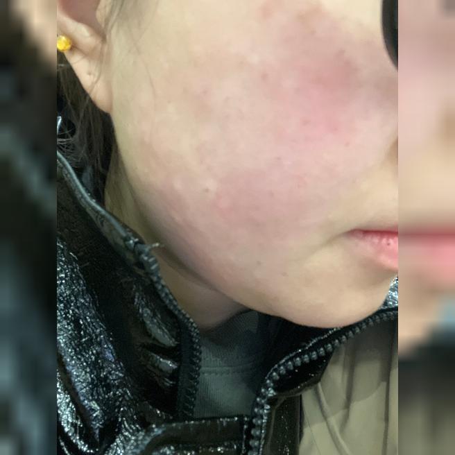 30대 관리 시작했는데 친절하고 잘해주셔서 또 왔어요~
