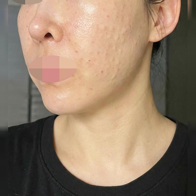 지인 추천으로 받았는데 확실히 달라져서 너무 만족이에요~
