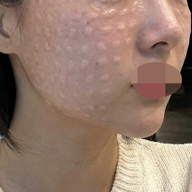 잔주름 고민으로 쥬베룩, 엠보 촘촘하게 잘 나와서 만족이에요!!