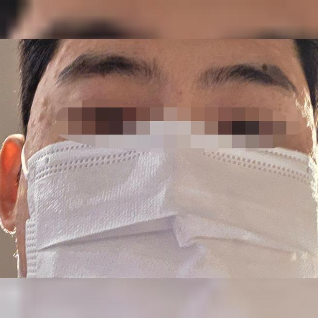 여드름 피부 때문에 추천받아서 리쥬란 받아봤습니다.