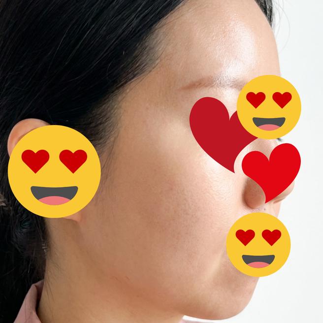 쥬베룩 연어주사 같이 맞은 지 열흘, 솔직 변화 공유합니다