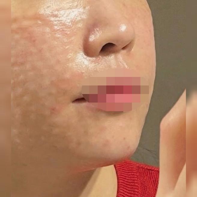엠보 맛집 인정! 촘촘하고 꼼꼼해서 계속 다니려고요 ㅎㅎ