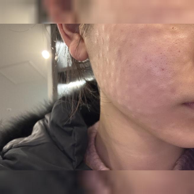속건조 때문에 별걸 다 해봤는데 여기서 1회차부터 효과 봤어요~ 정착 각!