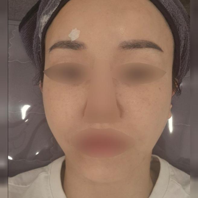 리쥬란 받았는데 한땀한땀 장인정신 느껴져서 재방문 했어요!!