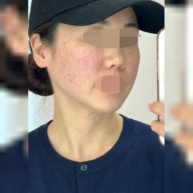 시너지 효과 보려고 같이 받았는데 결과까지 만족이에요~ㅎㅎ