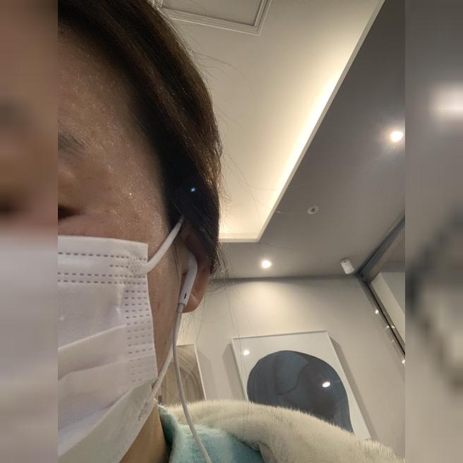 리쥬란 맞으면 멍 걱정했는데 여긴 멍자국이 없어요~