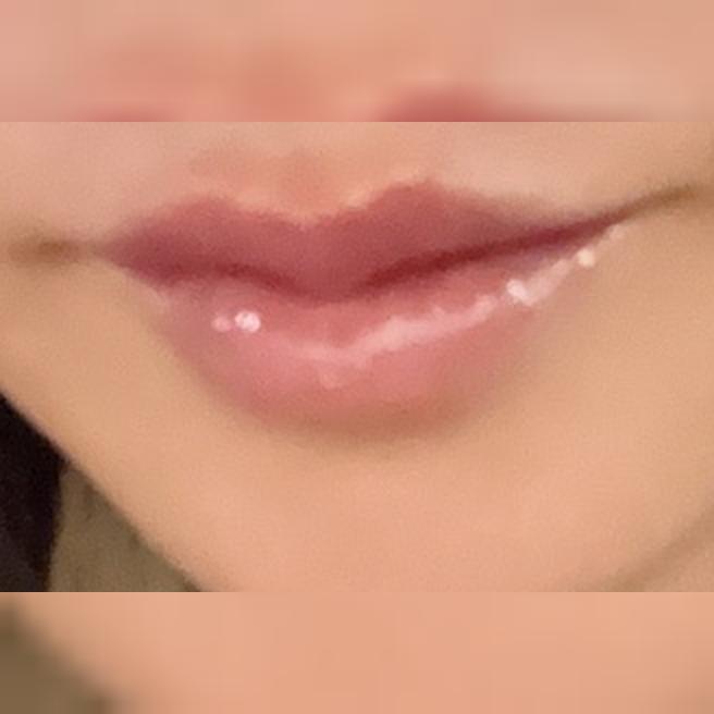 짧은 대기에 만족스러운 상담, 입술필러는 여기서 받기로 했어요~