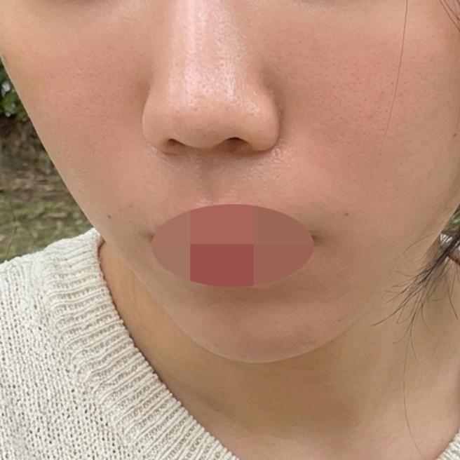 입체감 없던 얼굴, 레디어스로 자연스럽게 채워봤어요ㅎ