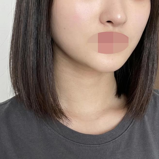 부담 없이 설명해주셔서 편하게 받았고 대만족이에요!