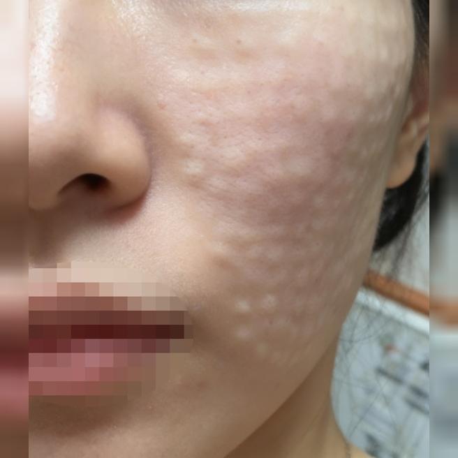 미스트 뿌려도 시간 지나면 푸석해서 리쥬네 받아봤어요!