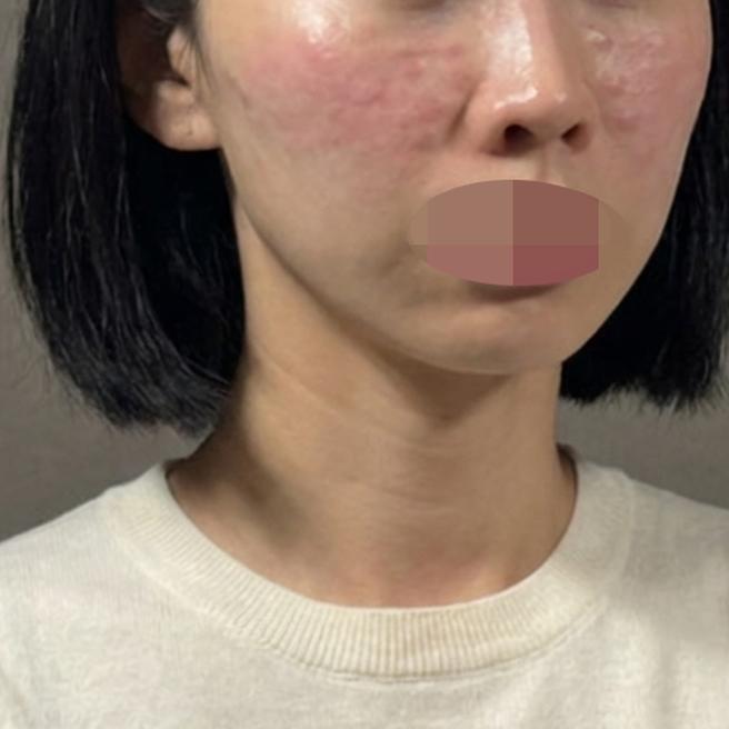 속건조 때문에 왔는데 가격도 저렴하고 만족이에요~
