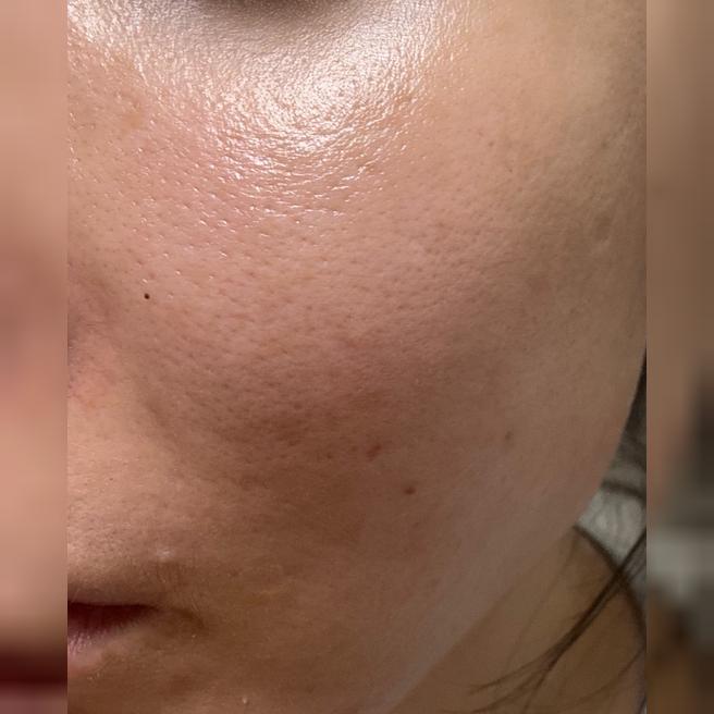 니즈에 맞게 꼼꼼히 해주셔서 만족이에요! 리즈네 받으면 확실히 좋아서 꾸준히 받고 있어요 ㅎㅎ