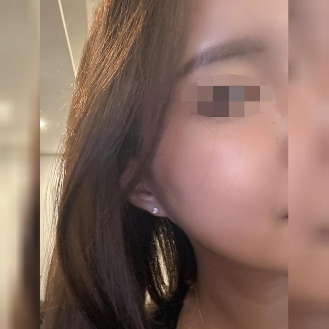 쥬베룩 받았는데 수면이라 편하고 효과 최고예요 ㅎㅎ
