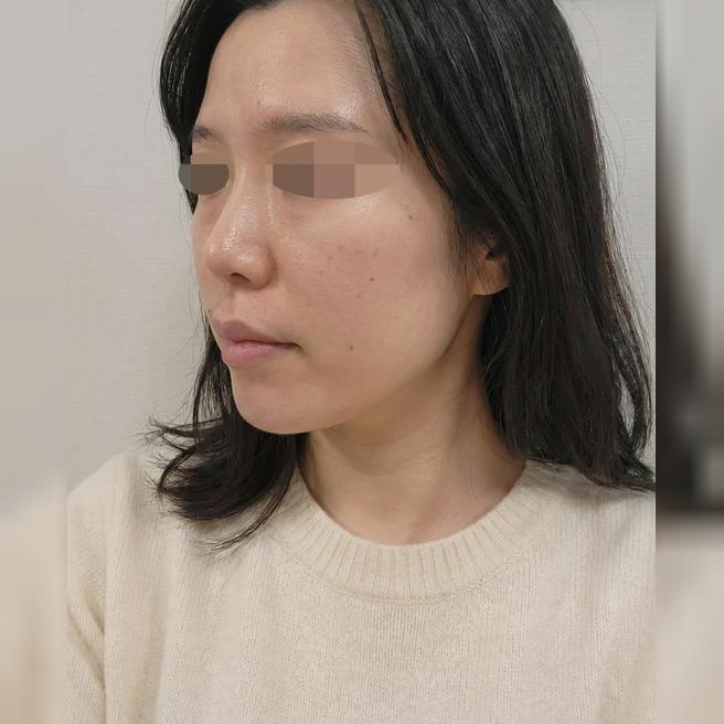 건조+홍조 때문에 처음 받아봤는데 엠보 촘촘해서 기대돼요ㅎㅎ