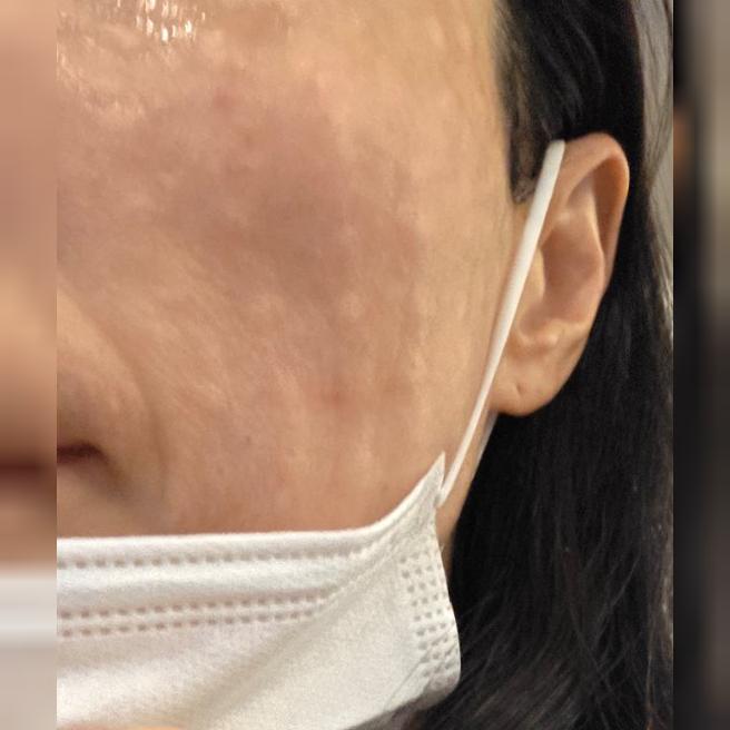 상담하다가 리쥬쎄라로 바로 결정해버렸어요~!