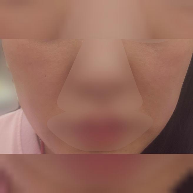 일주일 만에 건조함 사라지고 보들 탱탱한 피부가 됐어요!