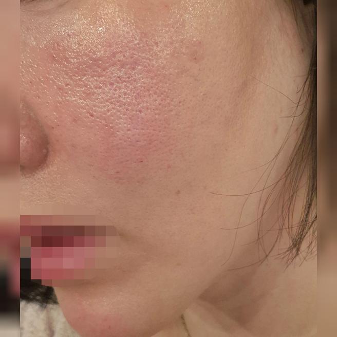 가격도 시술도 만족스러워서 매달 방문 예정이에요ㅎㅎ