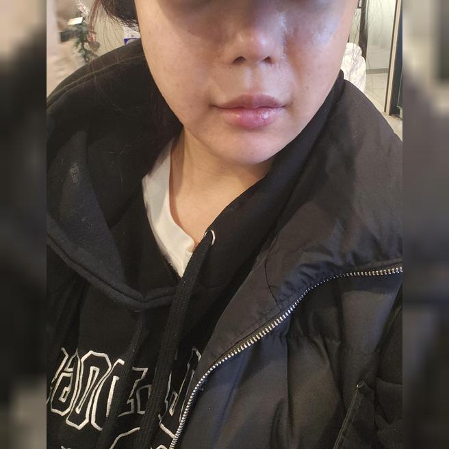 첫 방문 효과 대박이라 재방문! 모공 순삭 조합