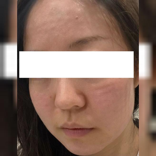 속건조 고민으로 왔는데 강요 없이 편하게 받았어요~ 웨딩 전 관리로 또 오려고요ㅎㅎ