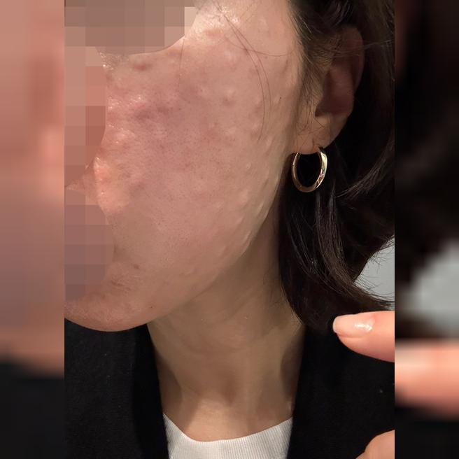 다른 병원이랑 다르게 추가 권유 없어서 좋았어요 ~!