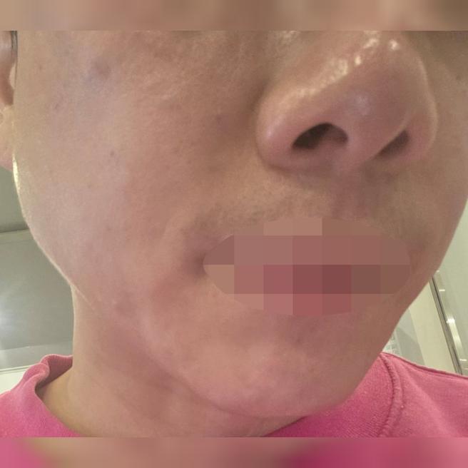 가격도 합리적이고 응대까지 친절해서 마음 편히 받고 왔습니다.
