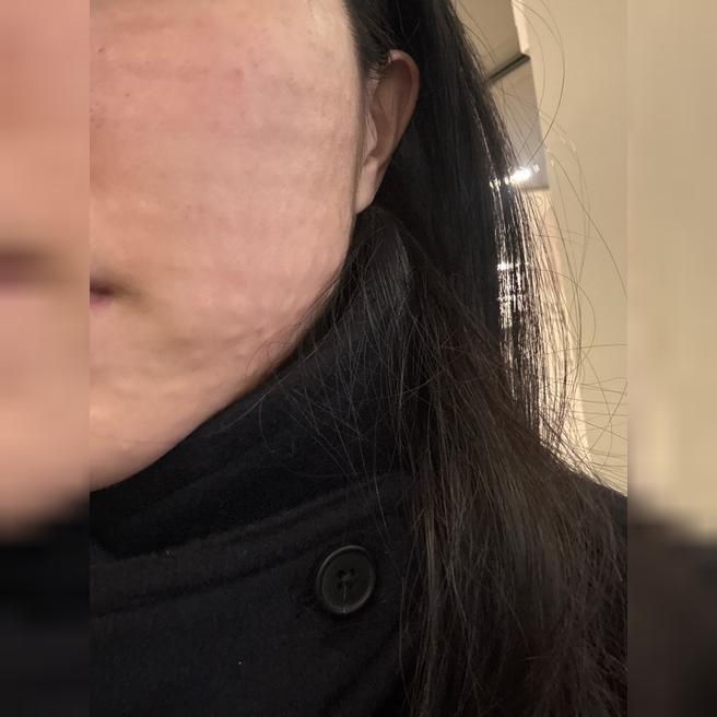 건조하고 잔주름 신경쓰여서 받았는데 만족이에요ㅎㅎ