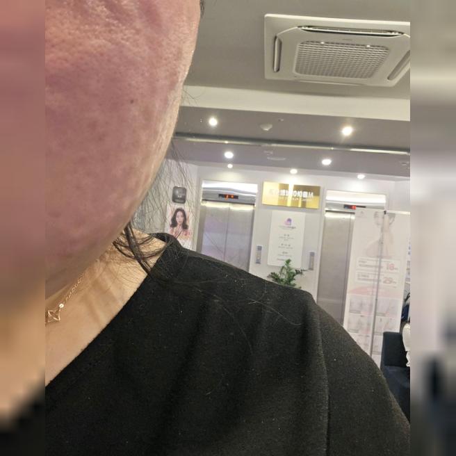친절하고 엠보도 만족스러워서 리쥬란 단골이 됐어요~!