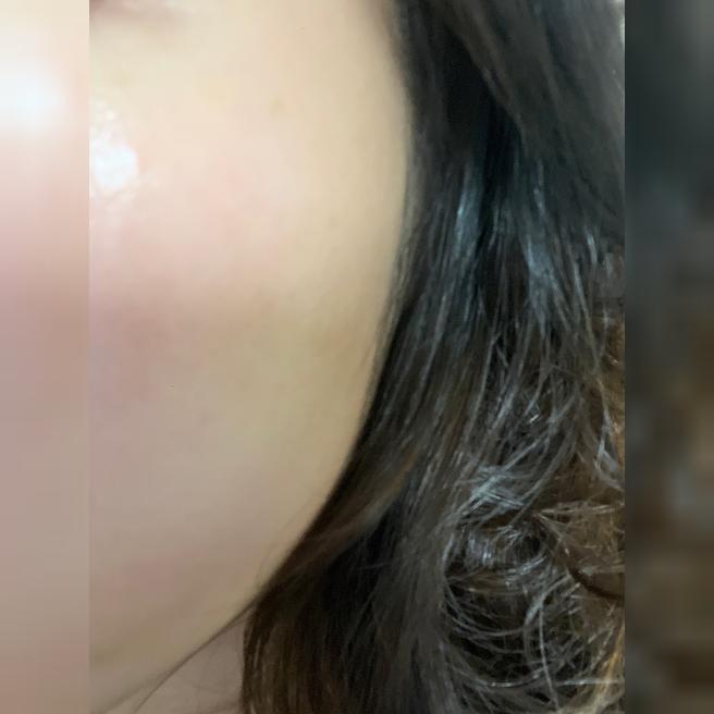 이곳저곳 다녀봤지만 리쥬란은 여기가 답이에요~