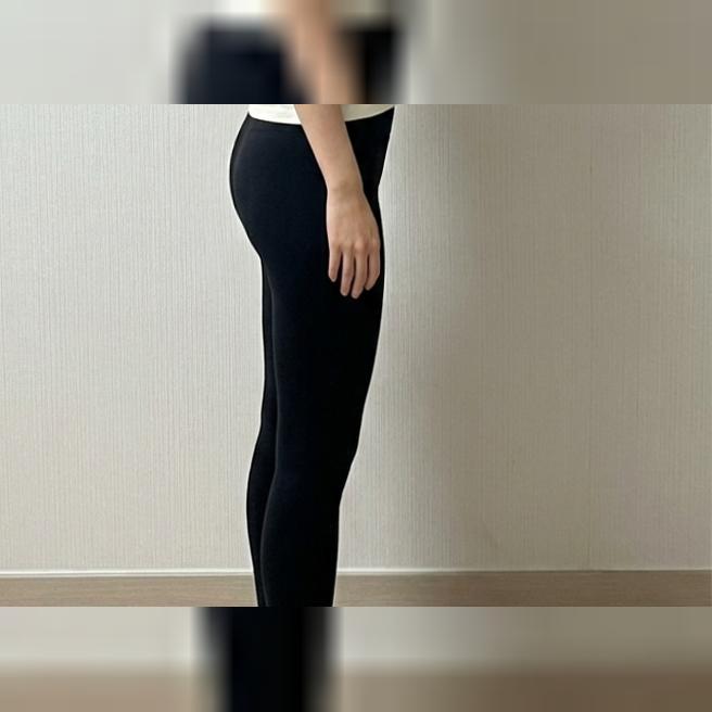 상담부터 시술까지 부담 없이~ 힙탱주사 받았어요~ㅎㅎ