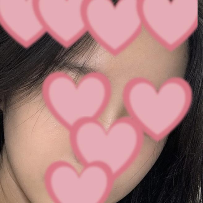 울쎄라 7일차, 자연스럽게 자리 잡는 중