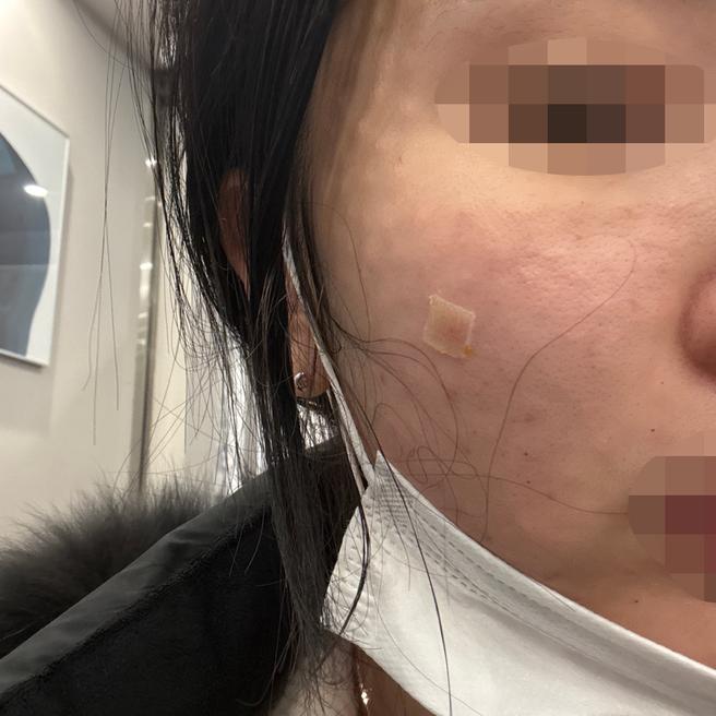 다른 병원이랑 차원이 다르게 꼼꼼해서 만족이에요 ㅎㅎ
