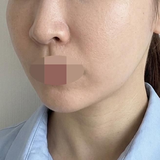 3일 차부터 속에서 광 올라오는 느낌!! 쥬베룩 너무 잘맞아요ㅎㅎ