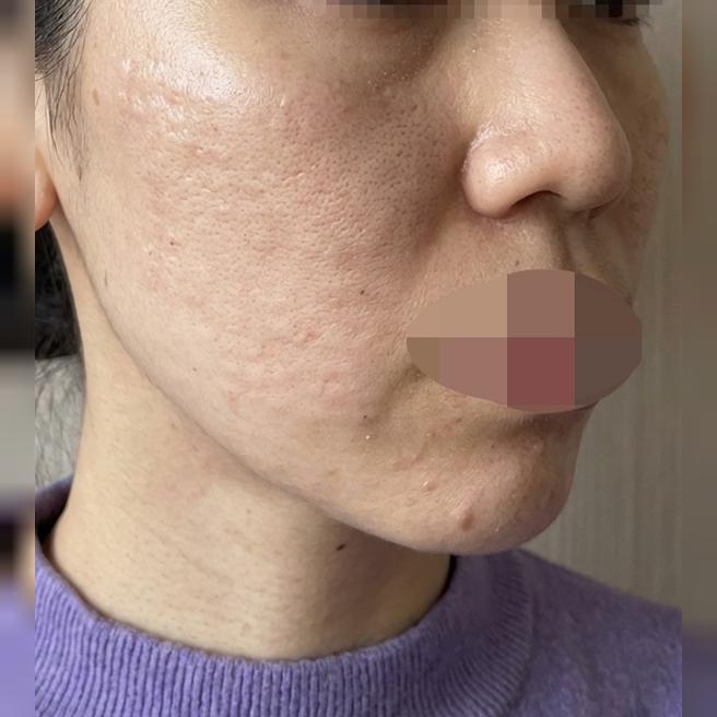 받은 지 1일인데 벌써 효과 보여서 만족이에요~
