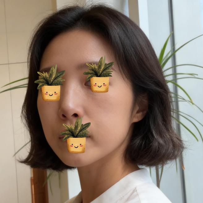 리쥬란+아이리쥬란 10일차 ^^ 붓기 다 빠지고 이제 기대되기 시작~