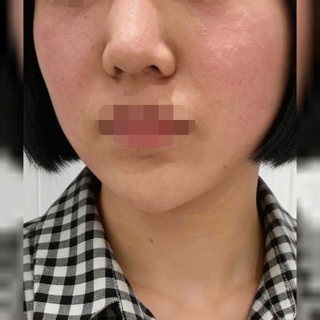 피부 속이 비어있는 느낌이었는데 리즈네 받고 바로 촉촉해진 느낌이 들어요~!